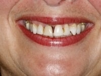 Konig Center for Cosmetic & Comprehensive Dentistry smile photos